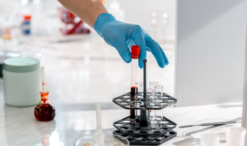 检测有毒物质需要多少样品量? 检测有毒物质需要多少样品量?