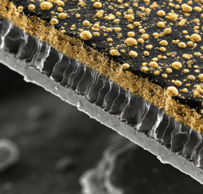 扫描电子显微镜喷碳与喷金的区别